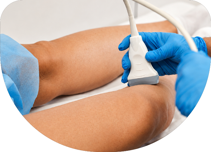 Ultrasonido Doppler venoso de extremidades