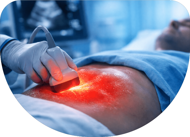 Ultrasonido abdominal