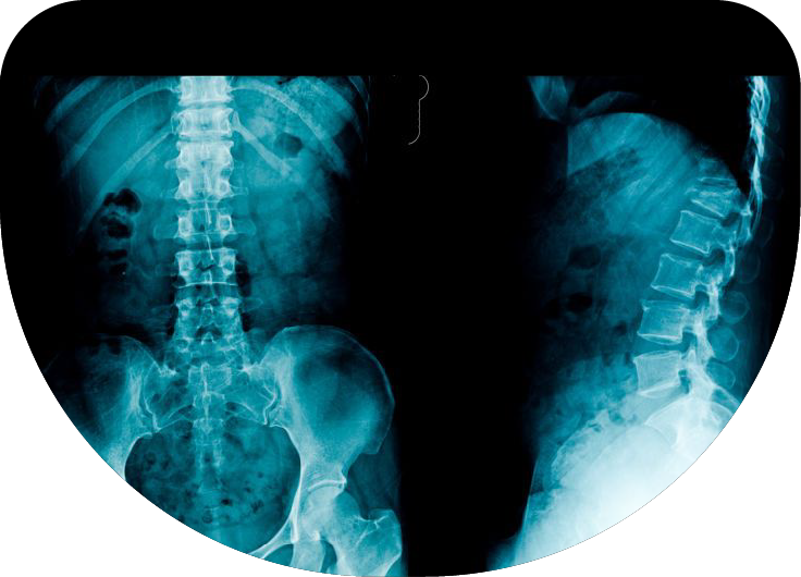 Radiografías de columna