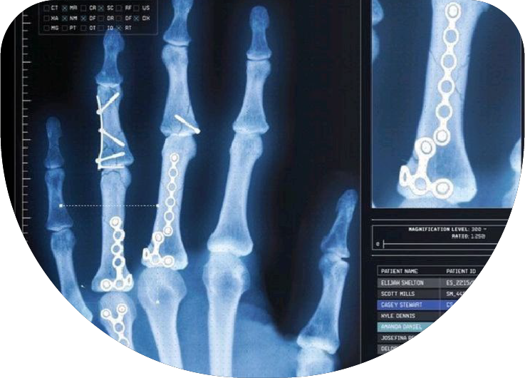 Radiografías de huesos y articulaciones