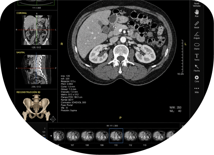 Tomografía de abdomen y pelvis